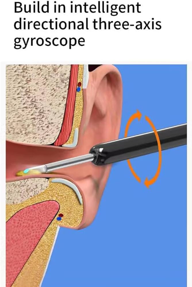 Otoscope Wi-Fi avec caméra HD